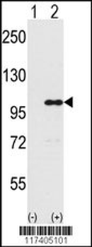 INPP5D Antibody (Center)