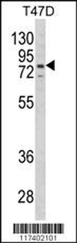 LTA4H Antibody (Center)