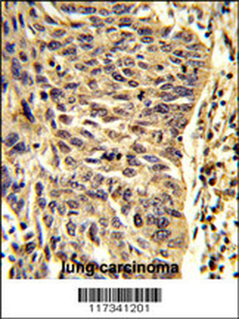 SNRPD1 Antibody (Center)