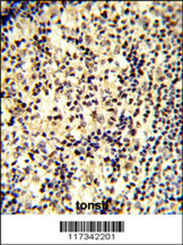 SNRPD1 Antibody (C-term)