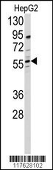 DHCR24 Antibody (N-term)