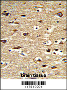 POLG2 Antibody (Center)