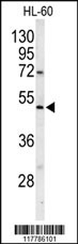 POLG2 Antibody (C-term)