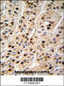 PCNA Antibody (C-term)