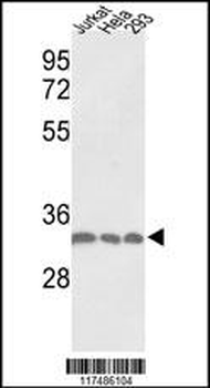 PCNA Antibody (C-term)