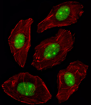 NPM1 Antibody (C-term)