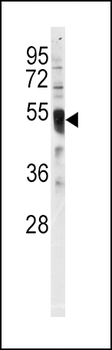 IRF8 Antibody (C-term)
