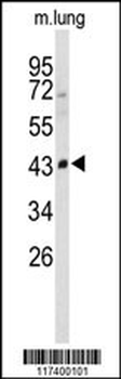SMPD2 Antibody (N-term)