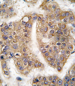 TRAIP Antibody (C-term)