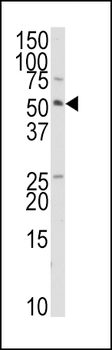 TRAIP Antibody (C-term)