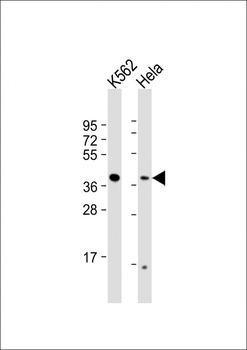 RFC2 Antibody (N-term)