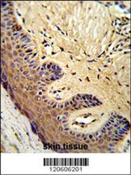 MCAM Antibody (Center)