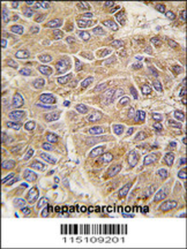 UGP2 Antibody (C-term)