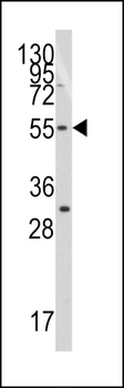 TRF (TERF1) Antibody (C-term)