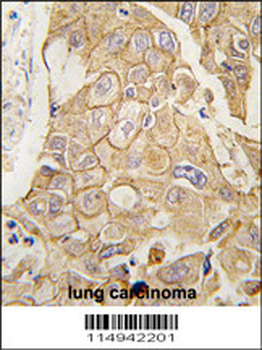 ADCY2 Antibody (C-term)