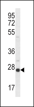 OPRS1 Antibody (Center)