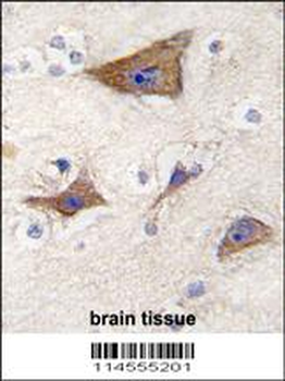 LGR5 (GPR49) Antibody (Center)