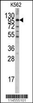 LGR5 (GPR49) Antibody (Center)