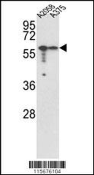 Vimentin Antibody (Center)