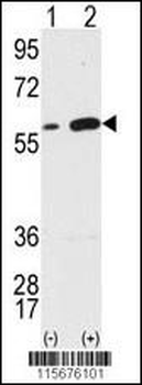 Vimentin Antibody (Center)