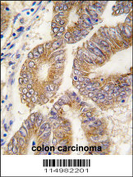 S adenosylhomocysteine hydrolase (ACHY) Antibody (C-term)