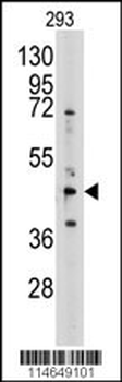 S adenosylhomocysteine hydrolase (ACHY) Antibody (N-term)