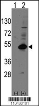 DAX1 (NR0B1) Antibody (C-term)