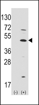 MATH1/HATH1/ATOH1 Antibody (C-term)