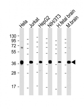 MATH1/HATH1/ATOH1 Antibody (N-term)