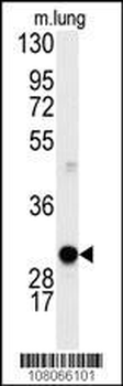 Cyclin D1 Antibody (S90)
