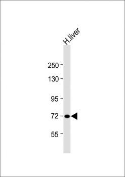 CPT2 Antibody (N-term)