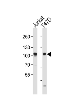 EZH2 Antibody