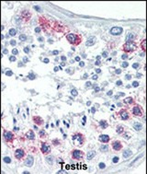 EZH2 Antibody (Center)