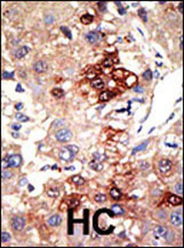 EZH2 Antibody (Center)