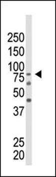 EZH2 Antibody (Center)