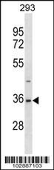 SAE1 (AOS1) Antibody (C-term)