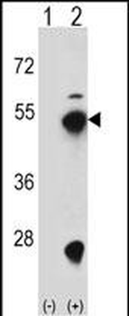 FDPS Antibody (N-term)