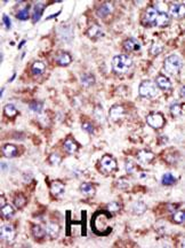 FDFT1 Antibody (N-term)
