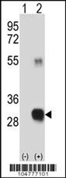 RCE1 Antibody (N-term W57)