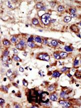 ZMPSTE24 Antibody (C-term)