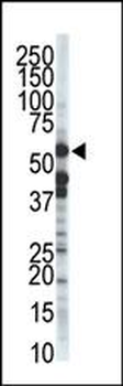 ZMPSTE24 Antibody (C-term)