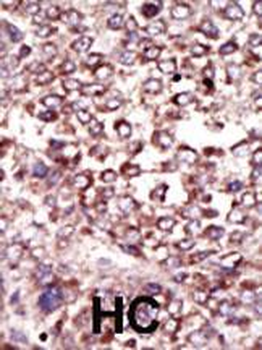 Ribophorin 2 (RPN2) Antibody (N-term)