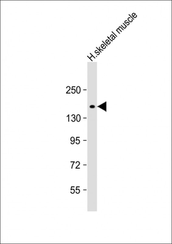 AGL Antibody (N-term)