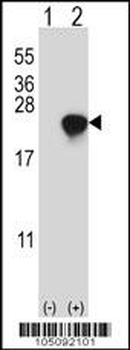 ARL2 Antibody (C-term)