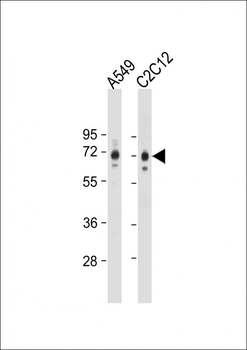 SQSTM1 (p62) Antibody (C-term)