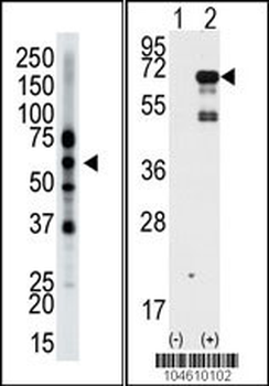 Epsin2 Antibody (N-term)