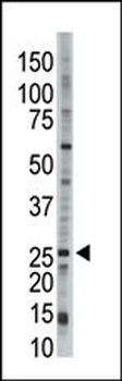 UBCH9 Antibody (C-term)