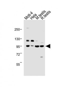 BAP1 Antibody (N-term)