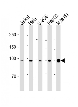 BAP1 Antibody (N-term)