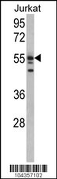 USP22 Antibody (N-term)